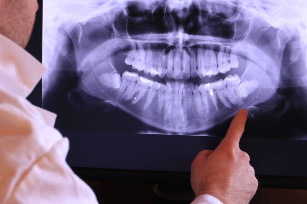 Best Emergency Care for Gum Disease in Lindstrom, MN